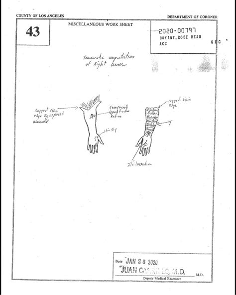 kobe and gigi autopsy|Kobe Bryant Autopsy Report: His Cause of Death。